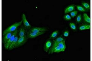 anti-Kinesin Family Member 17 (KIF17) (AA 500-777) antibody