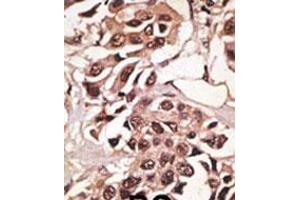 Image no. 2 for anti-Bone Morphogenetic Protein Receptor 1A (BMPR1A) (N-Term) antibody (ABIN357374) (BMPR1A anticorps  (N-Term))