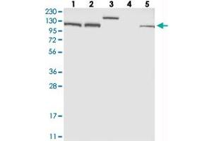 Western blot analysis of Lane 1: RT-4, Lane 2: U-251 MG, Lane 3: Human Plasma, Lane 4: Liver, Lane 5: Tonsil with EFTUD2 polyclonal antibody  at 1:250-1:500 dilution. (EFTUD2 anticorps)