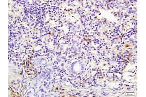 Formalin-fixed and paraffin embedded rabbit pancreas labeled with Rabbit Anti pro-caspase-3 Polyclonal Antibody, Unconjugated (ABIN747728) at 1:200 followed by conjugation to the secondary antibody and DAB staining (Caspase 3 anticorps  (AA 11-120))