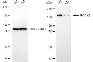 Western blotting analysis using ROCK1 antibody (ABIN7800203). (Recombinant ROCK1 anticorps)