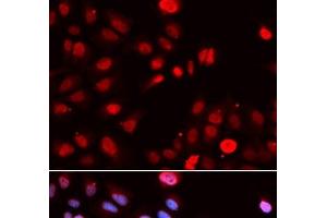 Immunofluorescence analysis of U2OS cells using MPG Polyclonal Antibody (MPG anticorps)