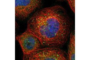 Immunofluorescent staining of human cell line A-431 shows localization to vesicles. (BAG5 anticorps  (AA 249-399))