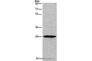Western blot analysis of Human bladder carcinoma tissue, using KLRF1 Polyclonal Antibody at dilution of 1:300 (KLRF1 anticorps)