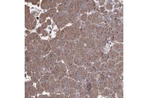 Immunohistochemical staining of human pancreas with OPTC polyclonal antibody  shows moderate cytoplasmic positivity in exocrine pancreas at 1:20-1:50 dilution.