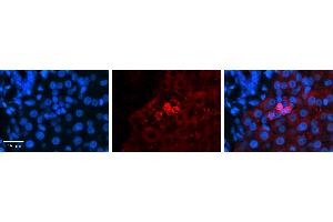SHMT2 antibody - C-terminal region          Formalin Fixed Paraffin Embedded Tissue:  Human Liver Tissue    Observed Staining:  Cytoplasm in Kupffer cells   Primary Antibody Concentration:  1:600    Secondary Antibody:  Donkey anti-Rabbit-Cy3    Secondary Antibody Concentration:  1:200    Magnification:  20X    Exposure Time:  0. (SHMT2 anticorps  (C-Term))