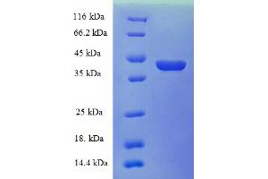 SDS-PAGE (SDS) image for Cellular Retinoic Acid Binding Protein 1 (CRABP1) (AA 2-137) protein (GST tag) (ABIN5709319)