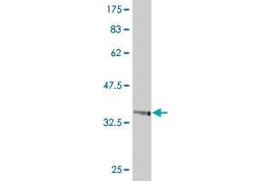 Western Blot detection against Immunogen (37.