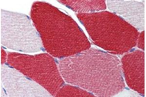 Skeletal muscle, Human: Formalin-Fixed, Paraffin-Embedded (FFPE)