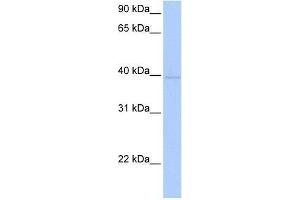 ZNF385D antibody used at 0. (ZNF385D anticorps  (C-Term))