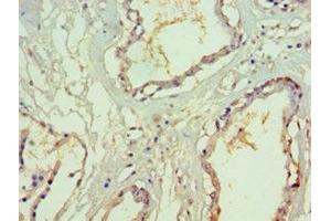 Immunohistochemistry of paraffin-embedded human prostate tissue using ABIN7170623 at dilution of 1:100