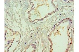 Immunohistochemistry of paraffin-embedded human prostate tissue using ABIN7170623 at dilution of 1:100 (SF3B3 anticorps  (AA 948-1217))