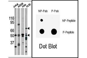 Image no. 1 for anti-Checkpoint Kinase 1 (CHEK1) (pSer317) antibody (ABIN358109) (CHEK1 anticorps  (pSer317))