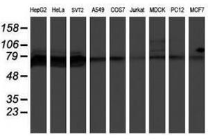 Image no. 3 for anti-Protein Phosphatase 1, Regulatory (Inhibitor) Subunit 15A (PPP1R15A) antibody (ABIN1498364)