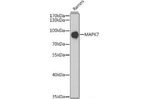 Western blot analysis of extracts of Ramos cells using MAPK7 Polyclonal Antibody at dilution of 1:1000. (MAPK7 anticorps)