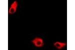 Immunofluorescent analysis of KIF2B staining in A549 cells. (KIF2B anticorps)