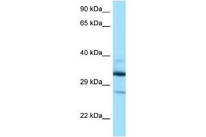 WB Suggested Anti-DOHH Antibody Titration: 1. (DOHH anticorps  (N-Term))
