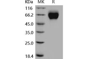 Western Blotting (WB) image for Interleukin 18 Receptor 1 (IL18R1) protein (His tag) (ABIN7196448)