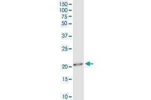 TWIST1 monoclonal antibody (M01), clone 3E11.