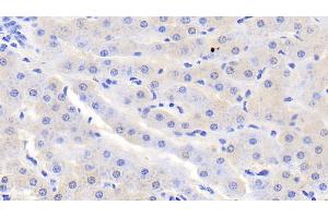 Detection of SDH in Bovine Liver Tissue using Polyclonal Antibody to Sorbitol Dehydrogenase (SDH)