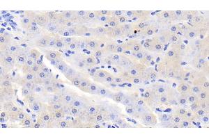 Detection of SDH in Bovine Liver Tissue using Polyclonal Antibody to Sorbitol Dehydrogenase (SDH) (SORD anticorps  (AA 4-344))
