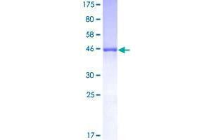Image no. 1 for Heat Shock 27kDa Protein 1 (HSPB1) (AA 1-205) protein (GST tag) (ABIN1307214)