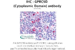 Image no. 1 for anti-G Protein-Coupled Receptor, Family C, Group 5, Member D (GPRC5D) (1st Cytoplasmic Domain) antibody (ABIN1735222) (GPRC5D anticorps  (1st Cytoplasmic Domain))