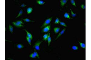 Immunofluorescent analysis of Hela cells using ABIN7159861 at dilution of 1:100 and Alexa Fluor 488-congugated AffiniPure Goat Anti-Rabbit IgG(H+L)