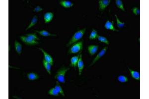Immunofluorescent analysis of Hela cells using ABIN7159861 at dilution of 1:100 and Alexa Fluor 488-congugated AffiniPure Goat Anti-Rabbit IgG(H+L) (Fission 1 anticorps  (AA 1-122))