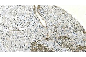 IHC analysis of H Cadherin/CDH13 using anti-H Cadherin/CDH13 antibody (ABIN7600095).