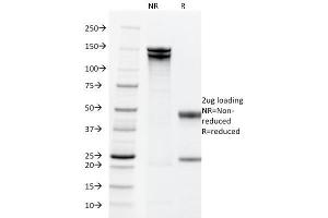 SDS-PAGE Analysis Purified EpCAM Mouse Monoclonal Antibody (PAN-EpCAM).