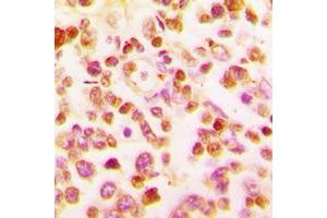 Immunohistochemical analysis of BCL6 staining in human tonsil formalin fixed paraffin embedded tissue section.
