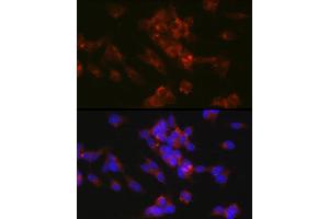 Immunofluorescence analysis of SH-SY5Y cells using [KO Validated] CD171/L1CAM Rabbit pAb (ABIN6131538, ABIN6143053, ABIN6143054 and ABIN7101826) at dilution of 1:150 (40x lens).