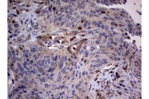 Image no. 5 for anti-Tuberous Sclerosis 1 (TSC1) (AA 836-1164) antibody (ABIN1491686) (TSC1 anticorps  (AA 836-1164))