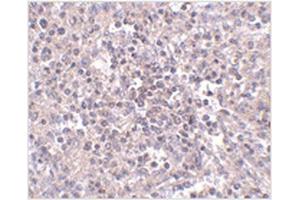 Immunohistochemistry of ZIP10 in human spleen tissue with ZIP10 antibody at 2.