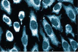 Immunofluorescence staining of human endothelial cells. (EIF2AK2 anticorps  (AA 117-250))