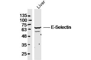 Mouse liver lysates probed with E-selectin Polyclonal Antibody, unconjugated  at 1:300 overnight at 4°C followed by a conjugated secondary antibody at 1:10000 for 90 minutes at 37°C. (Selectin E/CD62e anticorps  (AA 501-612))