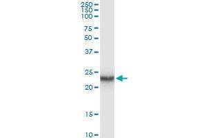 Immunoprecipitation of GUK1 transfected lysate using anti-GUK1 MaxPab rabbit polyclonal antibody and Protein A Magnetic Bead , and immunoblotted with GUK1 purified MaxPab mouse polyclonal antibody (B01P) .