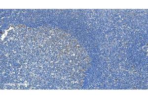 IHC analysis of DRP1/DNM1L using anti-DRP1/DNM1L antibody (ABIN7602180). (Dynamin 1-Like anticorps  (AA 618-736))