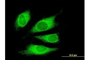 Immunofluorescence of monoclonal antibody to TG on HeLa cell.