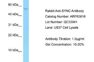 Western Blotting (WB) image for anti-Syncoilin (Sync) (C-Term) antibody (ABIN2789566) (Syncoilin anticorps  (C-Term))