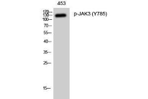 Western Blot analysis of 453 cells with Phospho-JAK3 (Tyr785) Polyclonal Antibody at dilution of 1:1000 (JAK3 anticorps  (pTyr785))