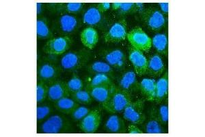 IF analysis of CD59 using anti-CD59 antibody (ABIN7600941).