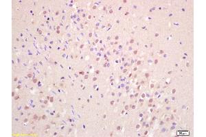 Formalin-fixed and paraffin embedded rat brain labeled with Anti-GNAQ/G? (GNAQ anticorps  (AA 51-150))