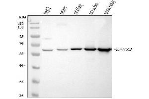 Western blot analysis of EPHX2 using anti-EPHX2 antibody (ABIN4886572). (EPHX2 anticorps  (C-Term))