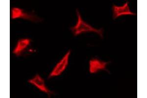 ABIN6274317 staining HuvEc by IF/ICC.