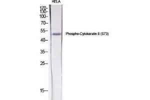 Western Blot (WB) analysis of specific cells using Phospho-Cytokeratin 8 (S73) Polyclonal Antibody. (KRT8 anticorps  (pSer73))