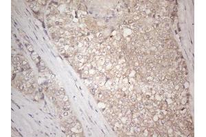 Immunohistochemistry (IHC) image for anti-Insulin-Like Growth Factor Binding Protein 1 (IGFBPI) (AA 26-259) antibody (ABIN2676854)