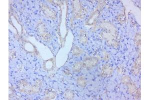 Paraformaldehyde-fixed, paraffin embedded mouse lymph tissue, Antigen retrieval by boiling in sodium citrate buffer(pH6) for 15min, Block endogenous peroxidase by 3% hydrogen peroxide for 30 minutes, Blocking buffer (normal goat serum) at 37°C for 20min, Antibody incubation with Rabbit Anti-STAT2 Polyclonal Antibody, Unconjugated  at 1:200 overnight at 4°C, followed by a conjugated secondary and DAB staining