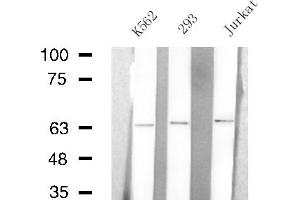 Western blot analysis of extracts from K562/293/Jurkat cells, using ARSE antibody. (Arylsulfatase E anticorps  (Internal Region))